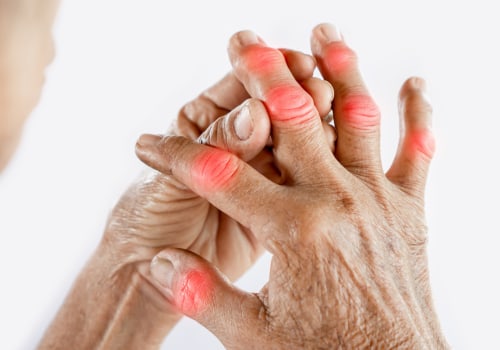 How do doctors confirm if you have arthritis?